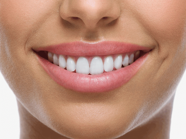 Cómo lograr una dentadura perfecta