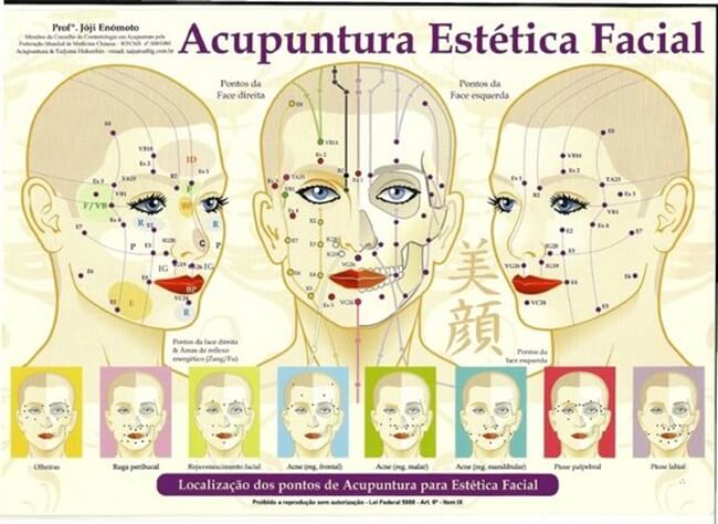 Acupuntura estética, el último tratamiento de moda entre las famosas