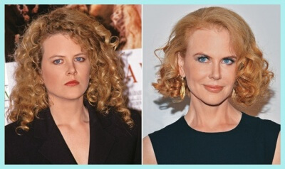 Nicole Kidman